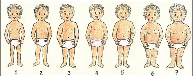 Toddler Silhouette Scale: 1- Underweight, 2-5 Normal, 6-7 Overweight Adapted from: Hager ER McGill AE, Black MM. Development and validation of a toddler silhouette scale. Obesity. 2010; 18(2):397-401